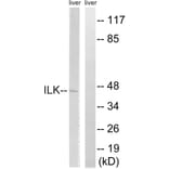 Western Blot - Anti-ILK Antibody (B8115) - Antibodies.com