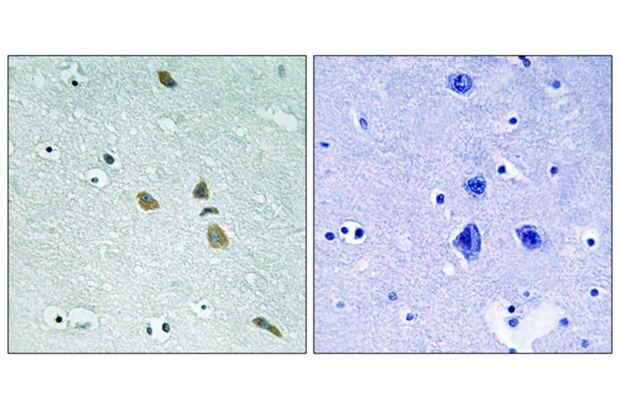 Immunohistochemistry - Anti-ILK Antibody (B8115) - Antibodies.com