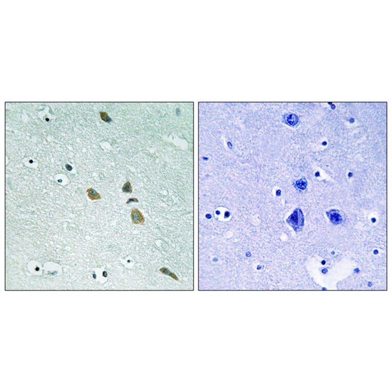 Immunohistochemistry - Anti-ILK Antibody (B8115) - Antibodies.com