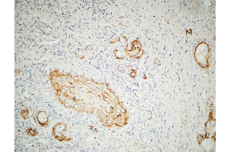 Immunohistochemistry - Anti-ILK Antibody (B8115) - Antibodies.com