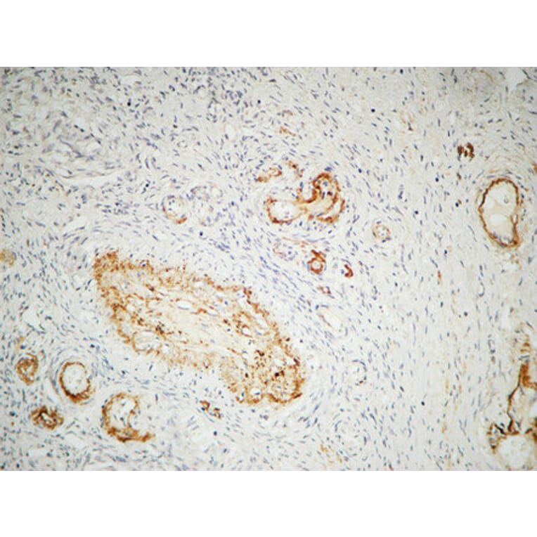 Immunohistochemistry - Anti-ILK Antibody (B8115) - Antibodies.com
