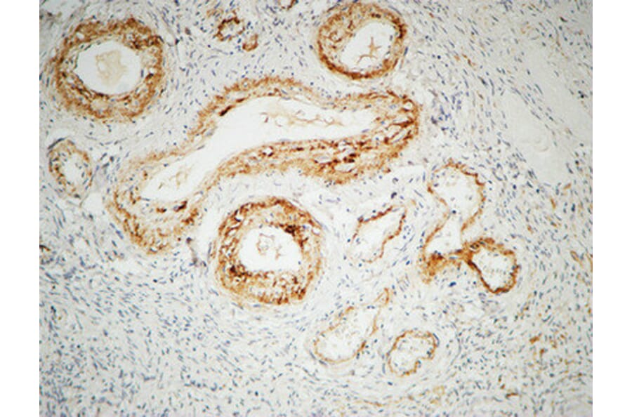 Immunohistochemistry - Anti-ILK Antibody (B8115) - Antibodies.com