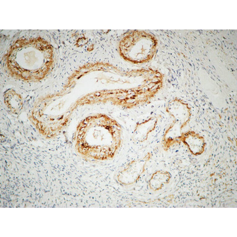 Immunohistochemistry - Anti-ILK Antibody (B8115) - Antibodies.com
