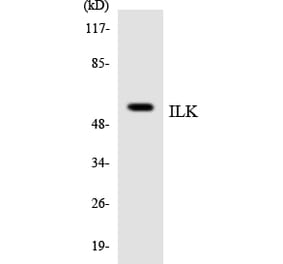 Western Blot - Anti-ILK Antibody (R12-2925) - Antibodies.com