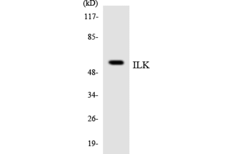 Western Blot - Anti-ILK Antibody (R12-2925) - Antibodies.com