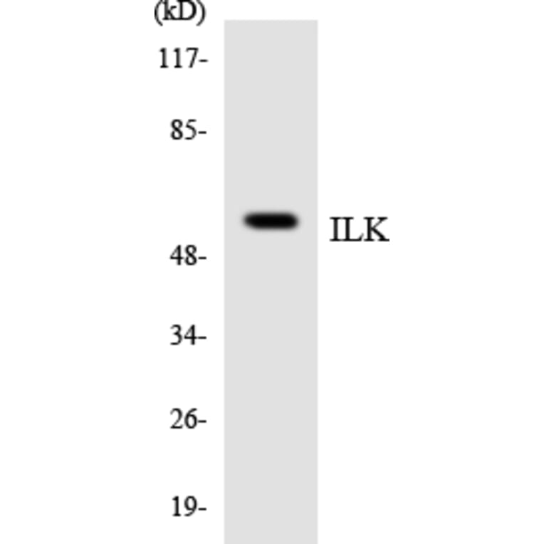 Western Blot - Anti-ILK Antibody (R12-2925) - Antibodies.com