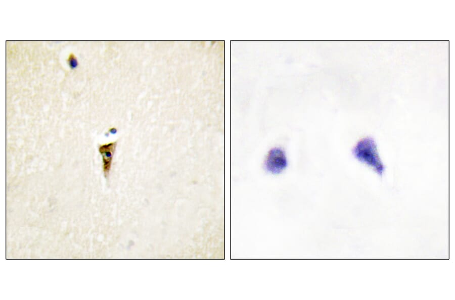 Immunohistochemistry - Anti-ICK Antibody (C11905) - Antibodies.com
