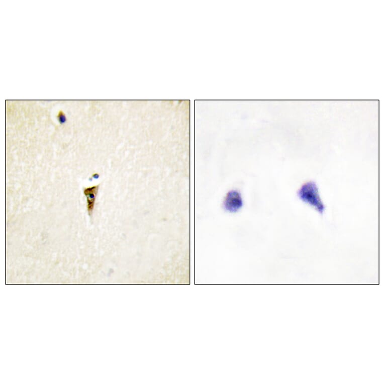 Immunohistochemistry - Anti-ICK Antibody (C11905) - Antibodies.com