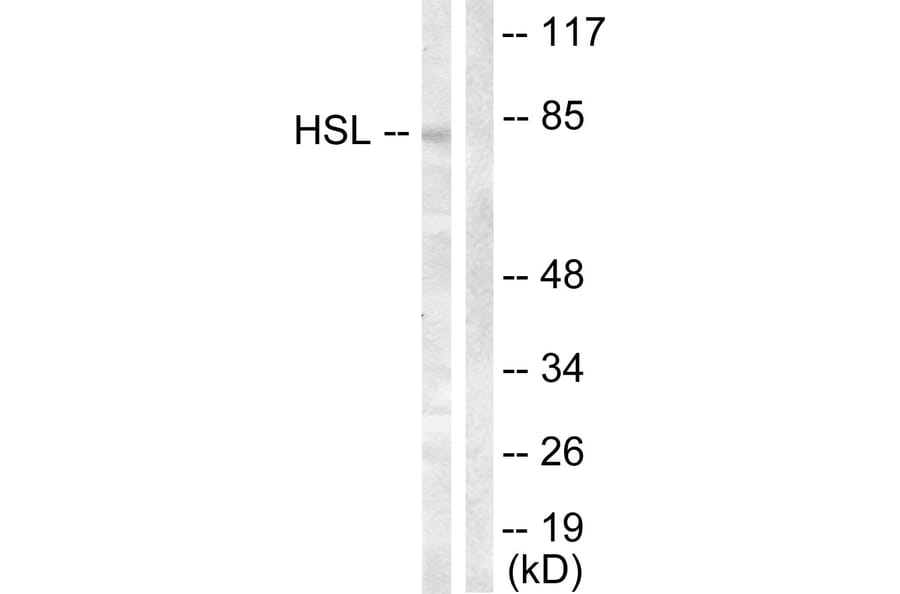 Western Blot - Anti-HSL Antibody (B0074) - Antibodies.com