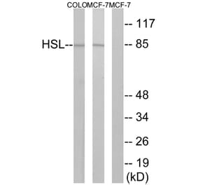 Western Blot - Anti-HSL Antibody (B0437) - Antibodies.com