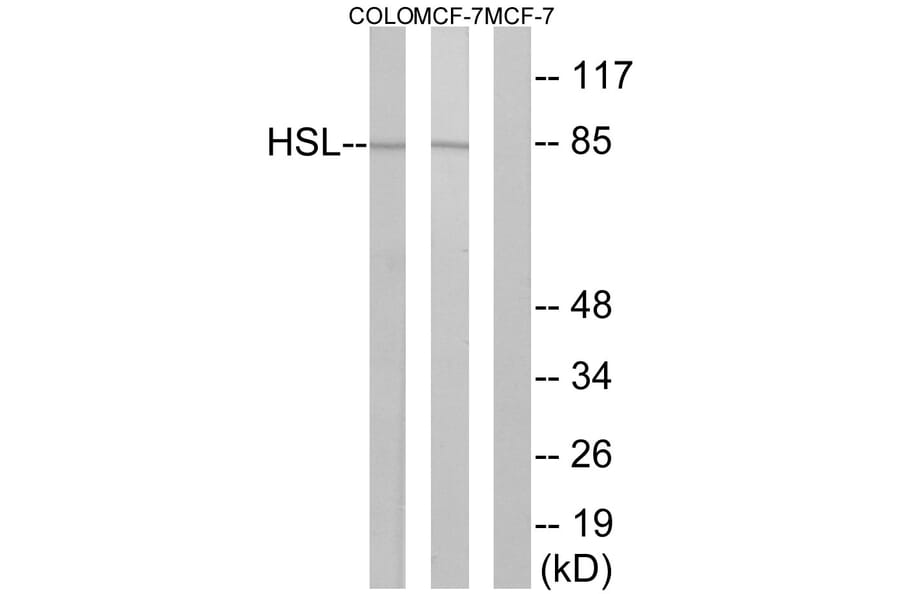 Western Blot - Anti-HSL Antibody (B0437) - Antibodies.com