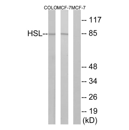 Western Blot - Anti-HSL Antibody (B0437) - Antibodies.com