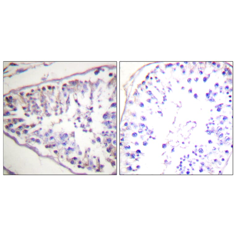 Immunohistochemistry - Anti-HSL Antibody (B0437) - Antibodies.com