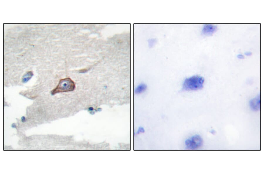 Immunohistochemistry - Anti-HCK Antibody (B0938) - Antibodies.com