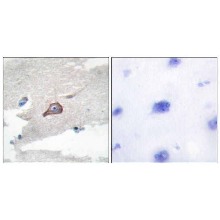 Immunohistochemistry - Anti-HCK Antibody (B0938) - Antibodies.com