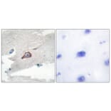 Immunohistochemistry - Anti-HCK Antibody (B0938) - Antibodies.com