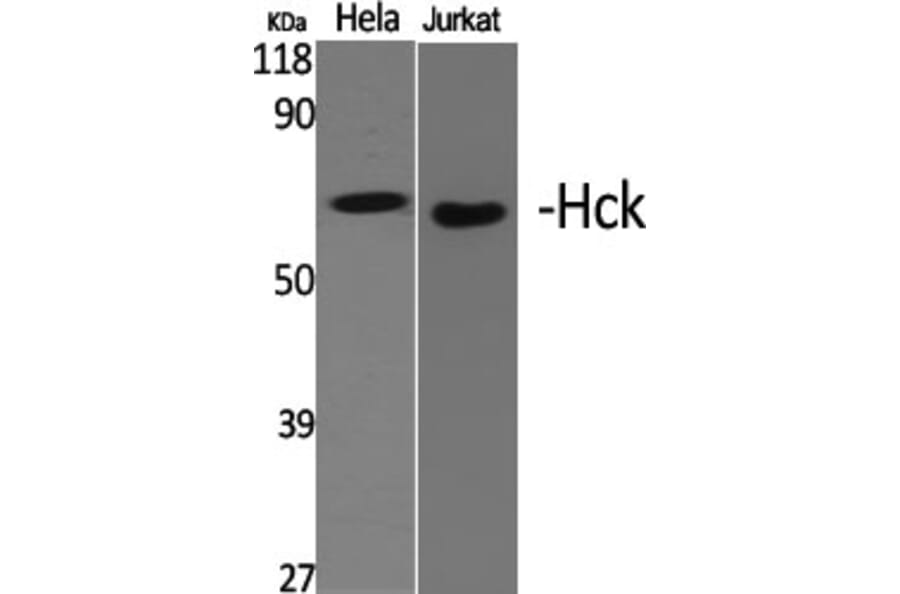 Western Blot - Anti-HCK Antibody (B0938) - Antibodies.com