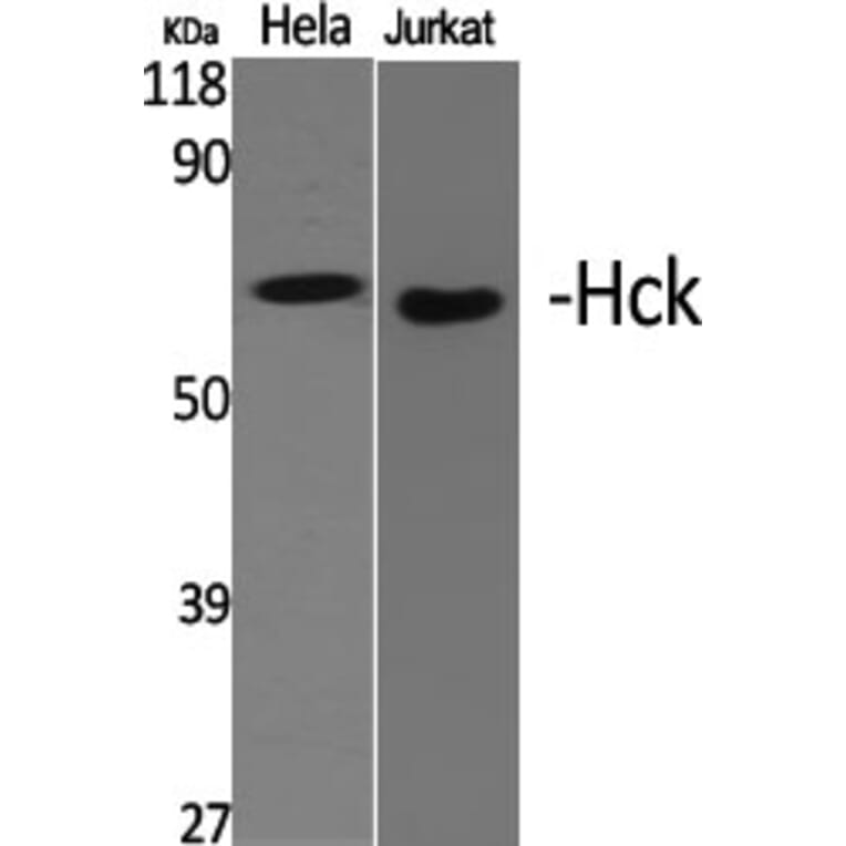 Western Blot - Anti-HCK Antibody (B0938) - Antibodies.com