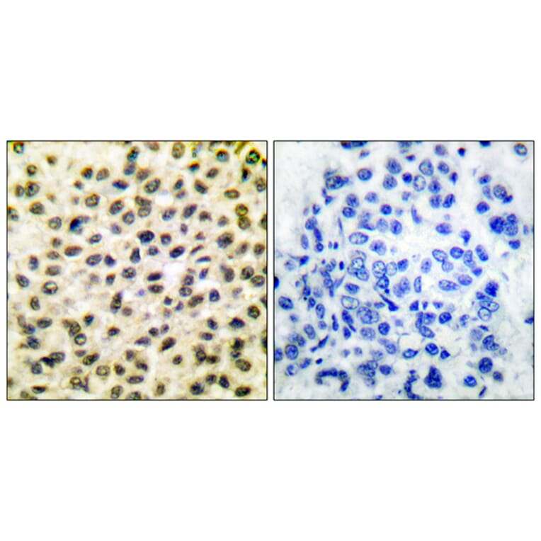 Immunohistochemistry - Anti-Fos Antibody (C0149) - Antibodies.com