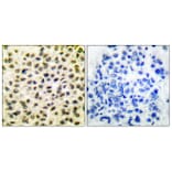 Immunohistochemistry - Anti-Fos Antibody (C0149) - Antibodies.com