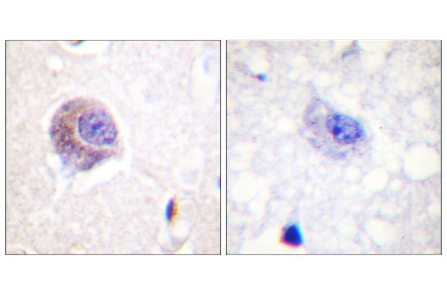 Immunohistochemistry - Anti-FAK Antibody (B0479) - Antibodies.com