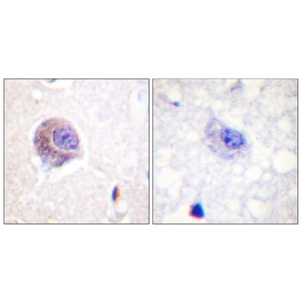 Immunohistochemistry - Anti-FAK Antibody (B0479) - Antibodies.com