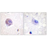 Immunohistochemistry - Anti-FAK Antibody (B0479) - Antibodies.com