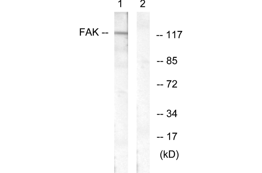Western Blot - Anti-FAK Antibody (B0479) - Antibodies.com
