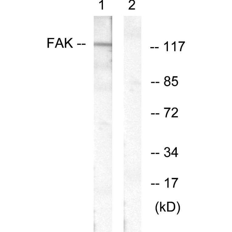 Western Blot - Anti-FAK Antibody (B0479) - Antibodies.com