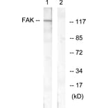 Western Blot - Anti-FAK Antibody (B0479) - Antibodies.com