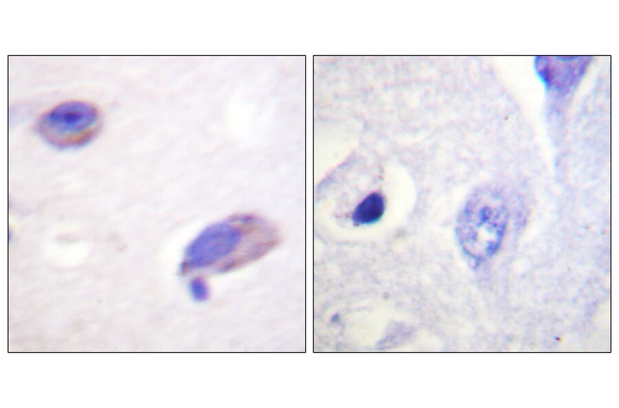 Immunohistochemistry - Anti-FAK Antibody (B0426) - Antibodies.com