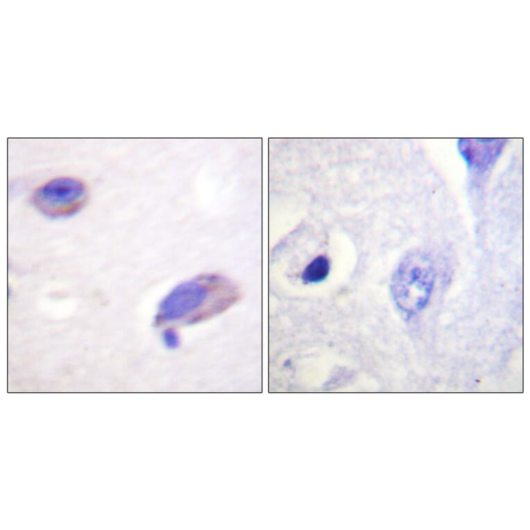 Immunohistochemistry - Anti-FAK Antibody (B0426) - Antibodies.com