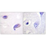 Immunohistochemistry - Anti-FAK Antibody (B0426) - Antibodies.com