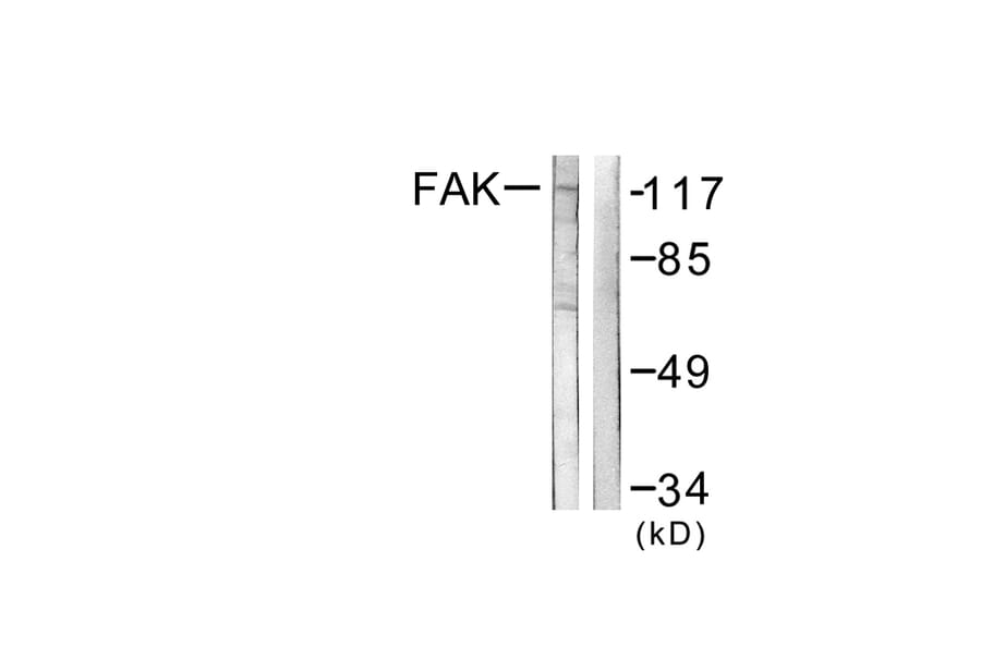 Western Blot - Anti-FAK Antibody (B0426) - Antibodies.com