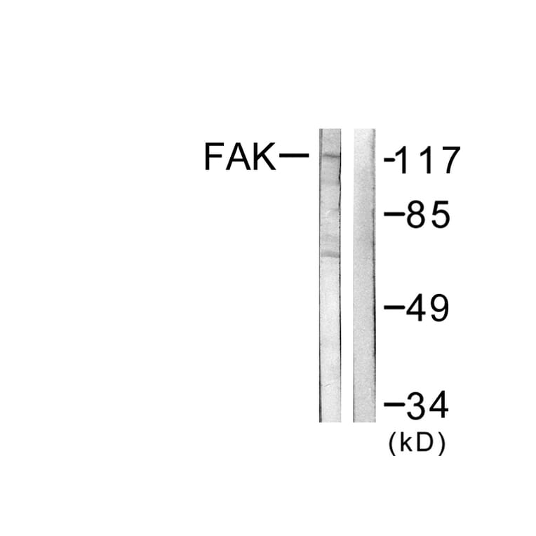 Western Blot - Anti-FAK Antibody (B0426) - Antibodies.com