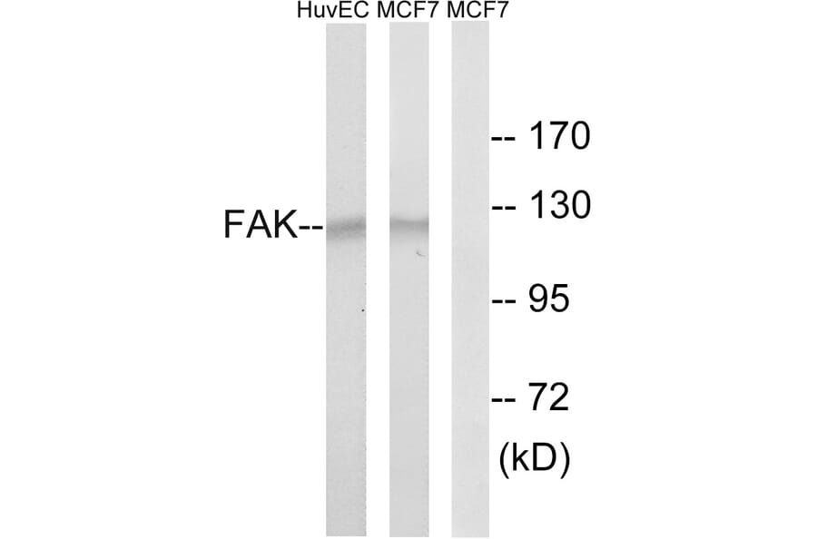 Western Blot - Anti-FAK Antibody (B8032) - Antibodies.com