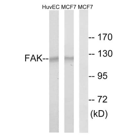 Western Blot - Anti-FAK Antibody (B8032) - Antibodies.com