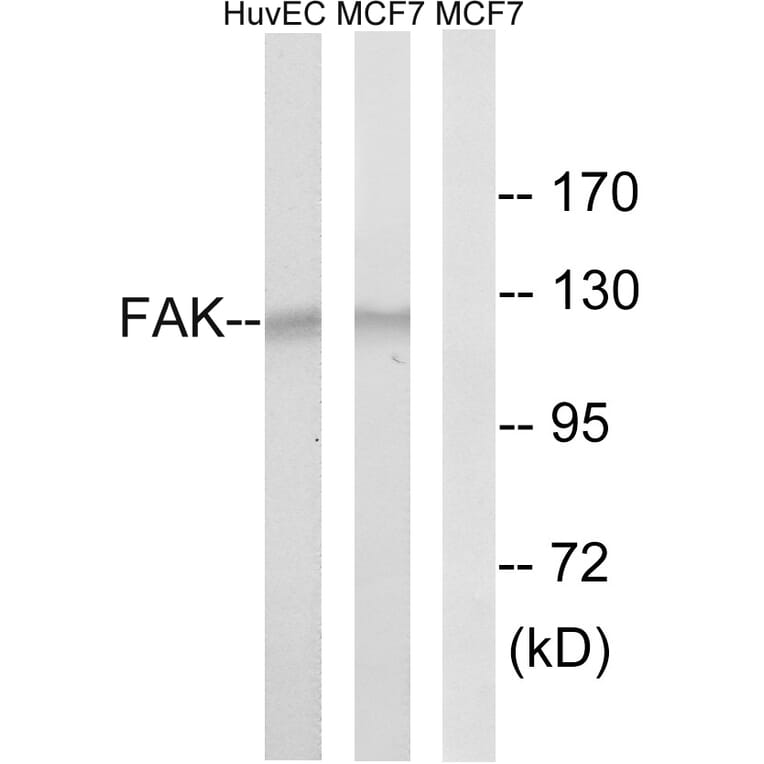 Western Blot - Anti-FAK Antibody (B8032) - Antibodies.com