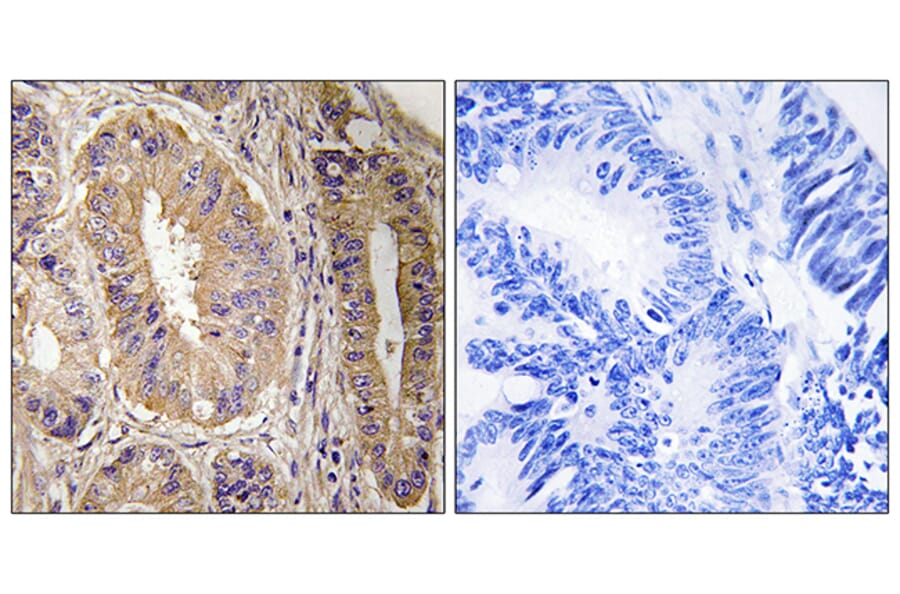 Immunohistochemistry - Anti-FAK Antibody (B8032) - Antibodies.com