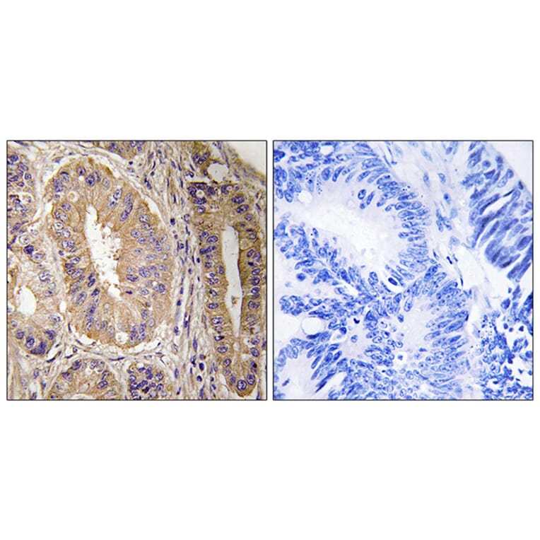 Immunohistochemistry - Anti-FAK Antibody (B8032) - Antibodies.com