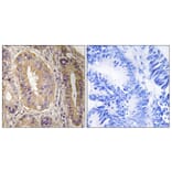 Immunohistochemistry - Anti-FAK Antibody (B8032) - Antibodies.com