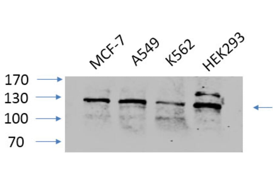 Western Blot - Anti-FAK Antibody (B8032) - Antibodies.com