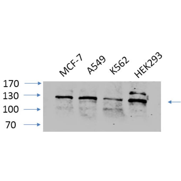 Western Blot - Anti-FAK Antibody (B8032) - Antibodies.com