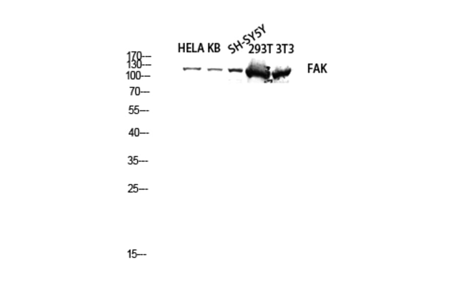 Western Blot - Anti-FAK Antibody (B8032) - Antibodies.com