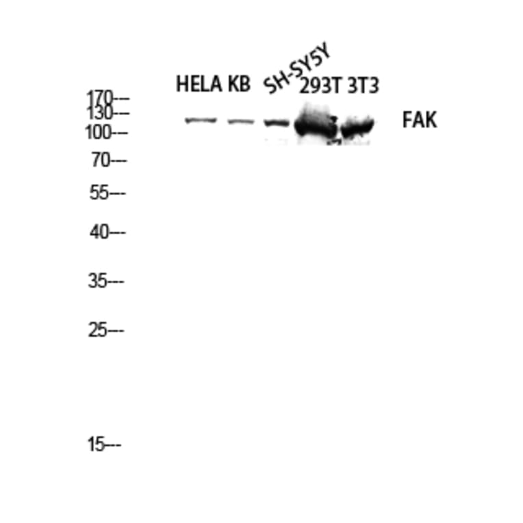 Western Blot - Anti-FAK Antibody (B8032) - Antibodies.com