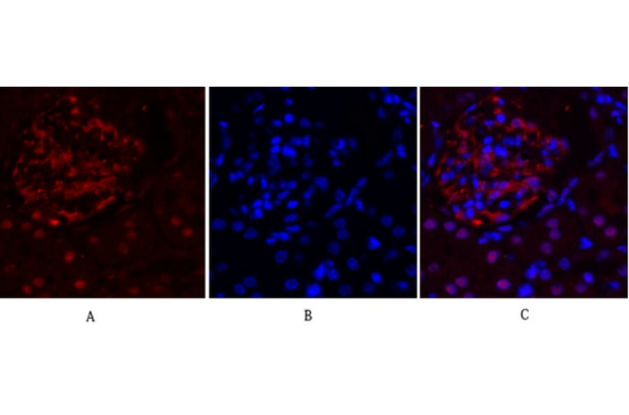 Immunofluorescence - Anti-FAK Antibody (B8032) - Antibodies.com