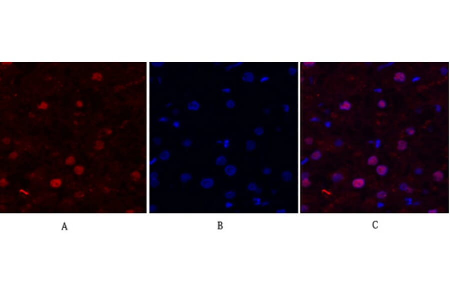 Immunofluorescence - Anti-FAK Antibody (B8032) - Antibodies.com