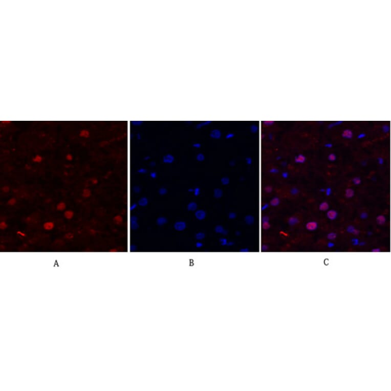 Immunofluorescence - Anti-FAK Antibody (B8032) - Antibodies.com