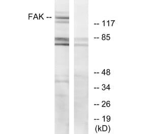 Western Blot - Anti-FAK Antibody (B7083) - Antibodies.com
