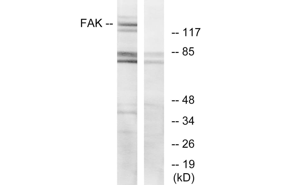 Western Blot - Anti-FAK Antibody (B7083) - Antibodies.com